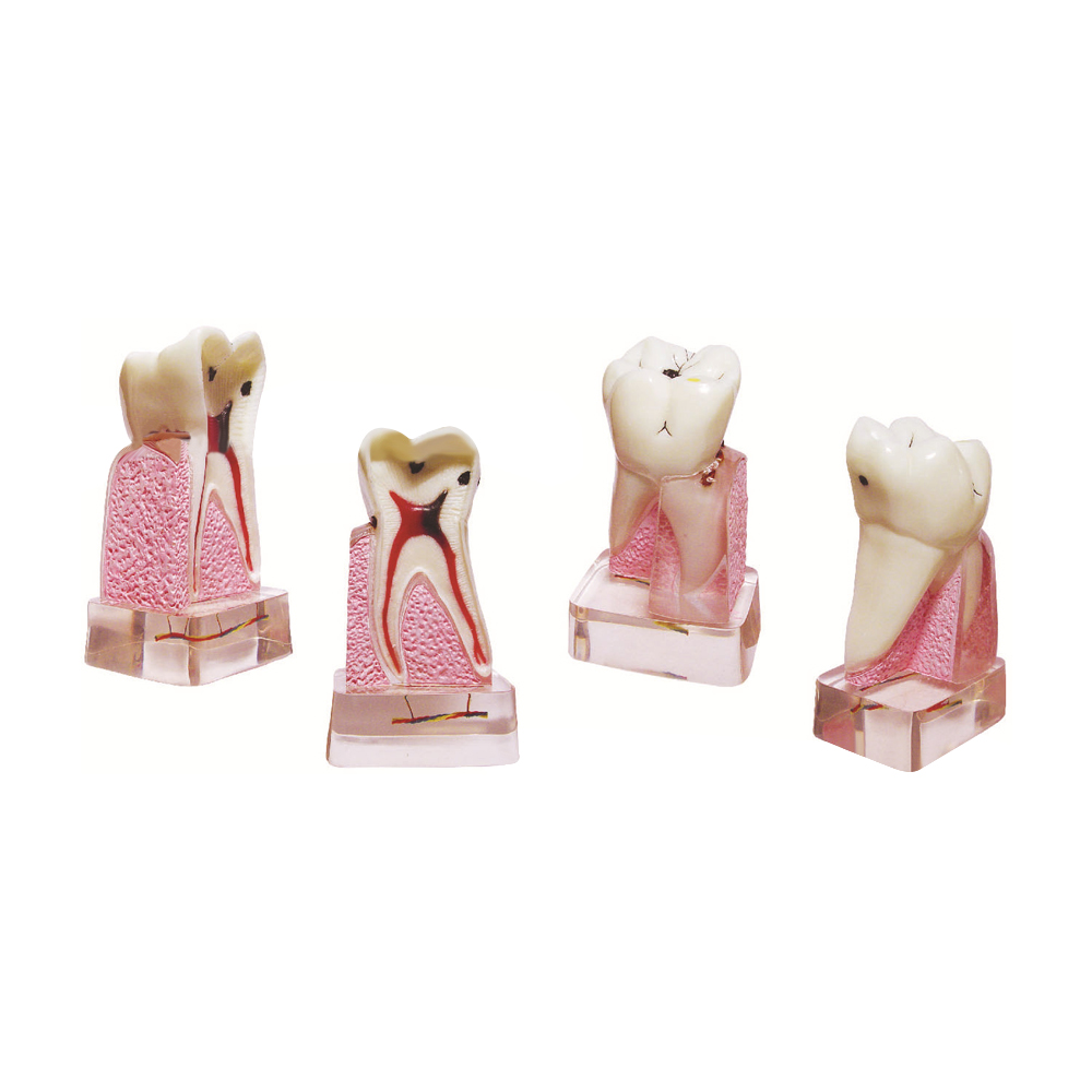 Dental Pathological Model, 4x  - Medical Lab Supplies recensione e prezzo