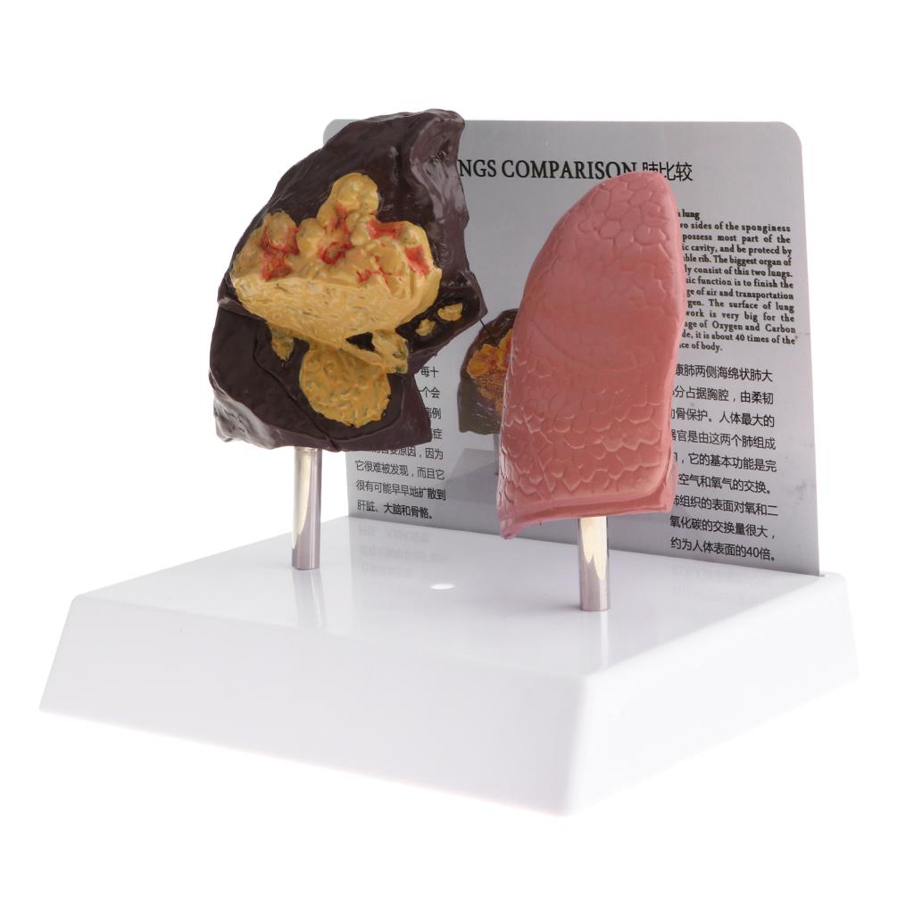 Human Lung Normal Comparison M - Medical Lab Supplies recensione e prezzo