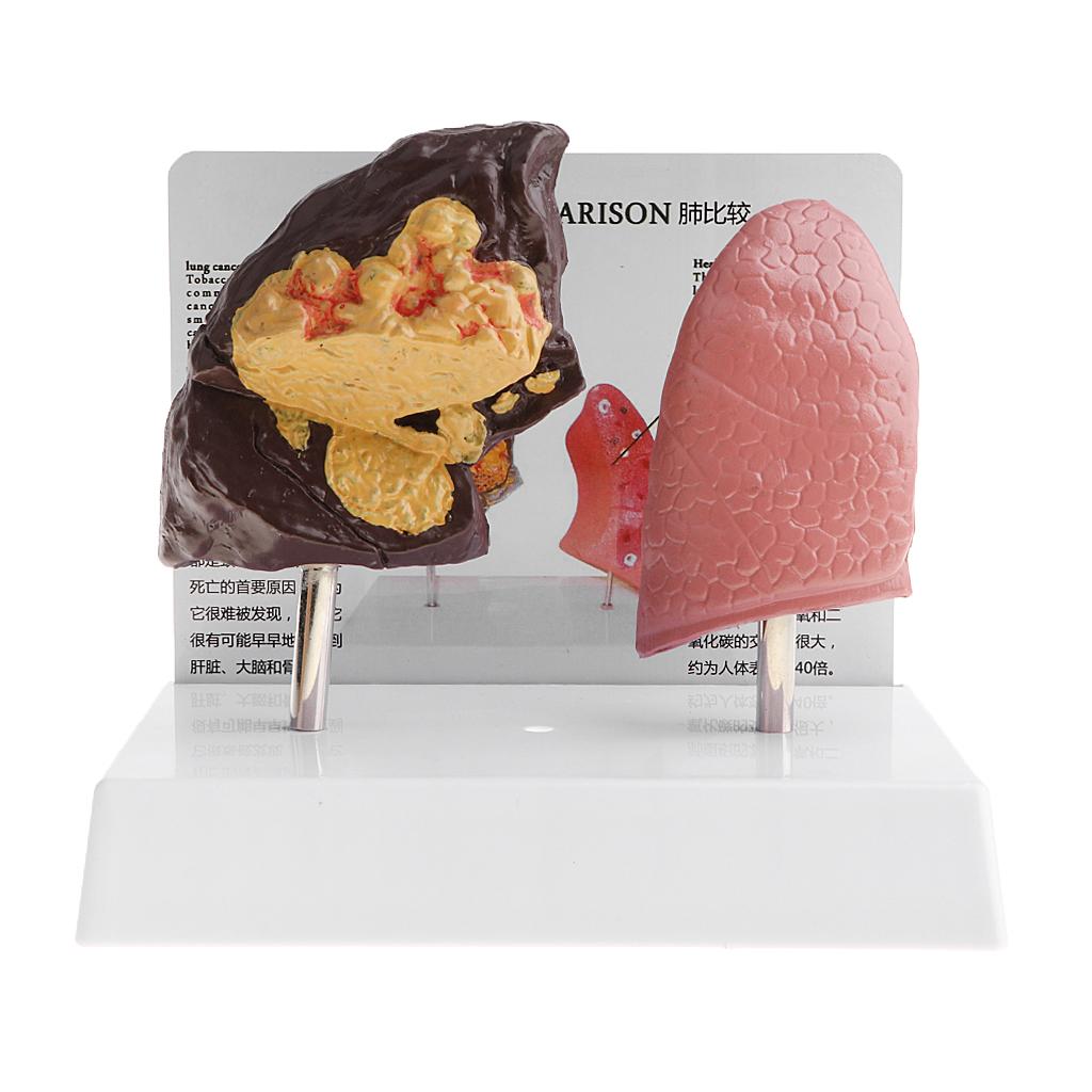 Human Lung Normal Comparison M - Medical Lab Supplies recensione e prezzo