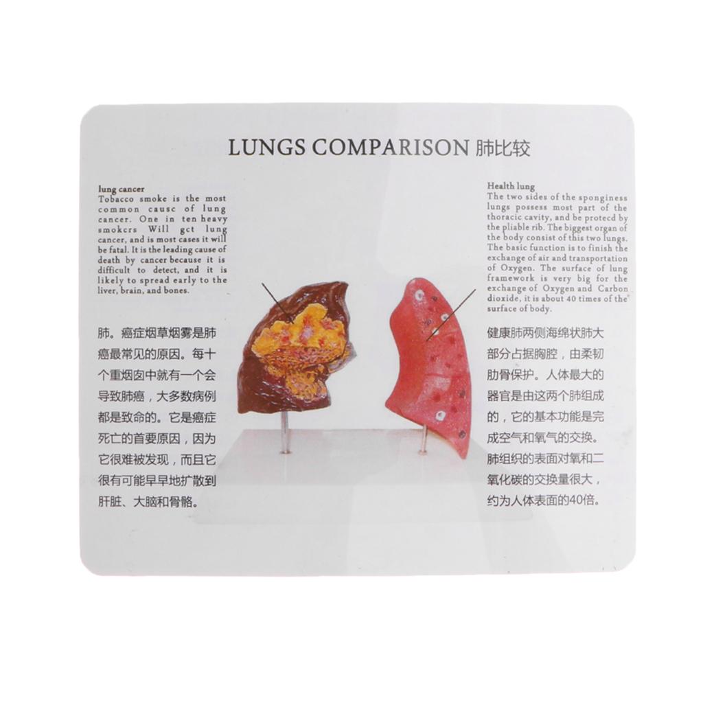 Human Lung Normal Comparison M - Medical Lab Supplies recensione e prezzo