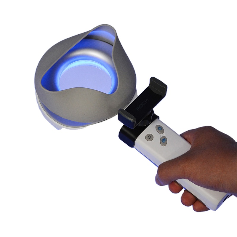 Skin Disorder  Depigmentation  - Led Medical Headlight recensione e prezzo