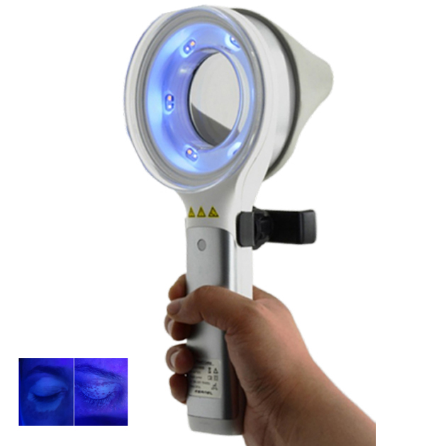 Skin Disorder  Depigmentation  - Led Medical Headlight recensione e prezzo