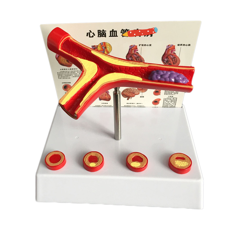 50 Times Enlarged Human Vessel - Medical Lab Supplies recensione e prezzo